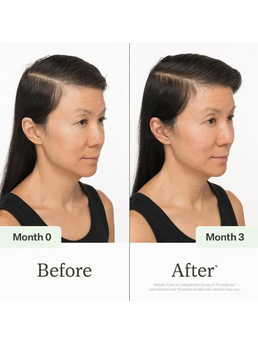 Revitalize Hair with Peptide Scalp Serum | Promotes Fuller-Looking Locks | 30ml